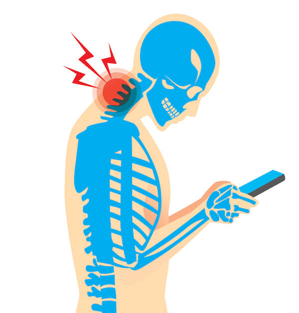 Graphic of neck pain