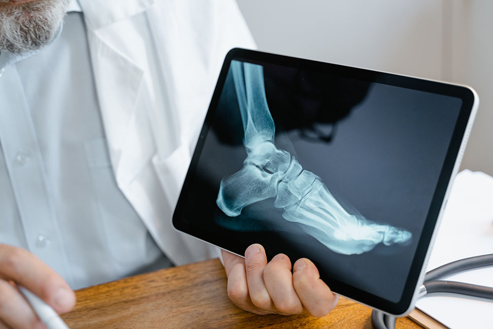 Doctor showing foot x-ray on ipad.