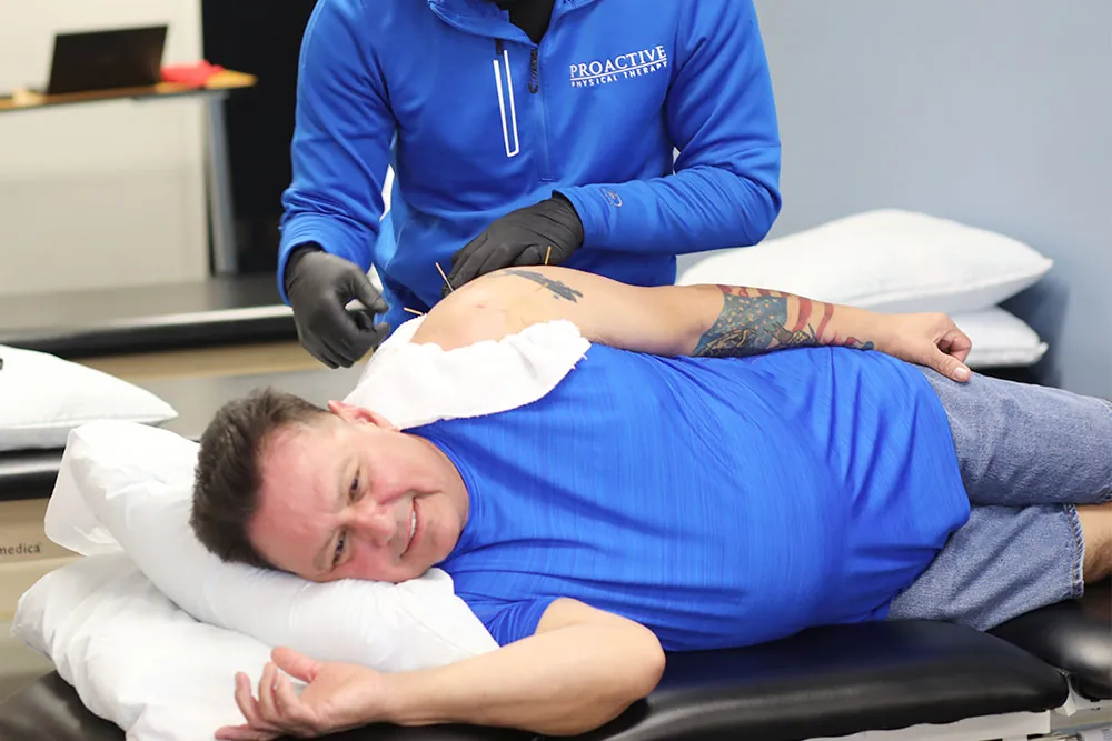 Physical therapist treating mans shoulder pain with dry needling treatment.
